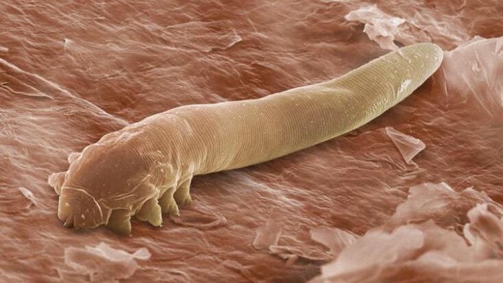 σκουλήκι που ζει κάτω από το ανθρώπινο δέρμα