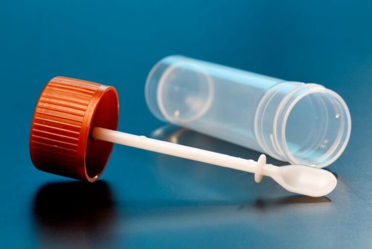 Ανάλυση CALAIS